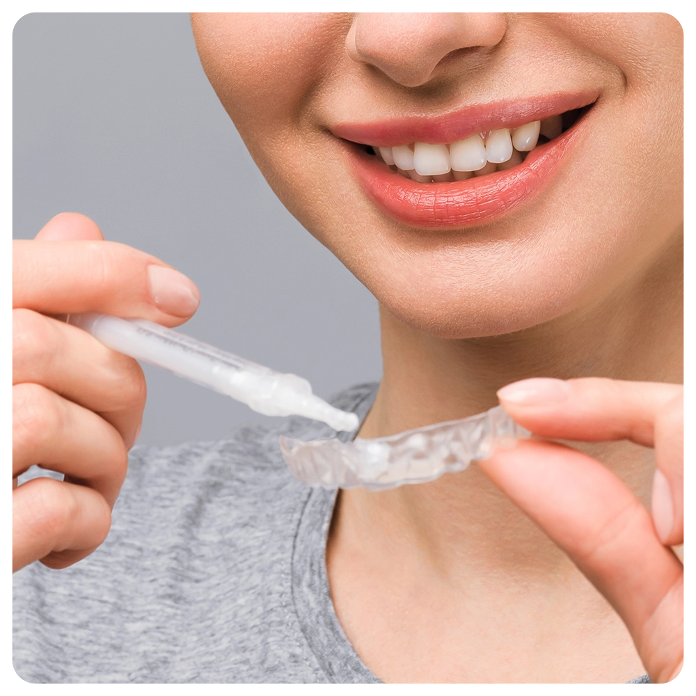 A young woman does a home teeth whitening procedure. Whitening tray with gel