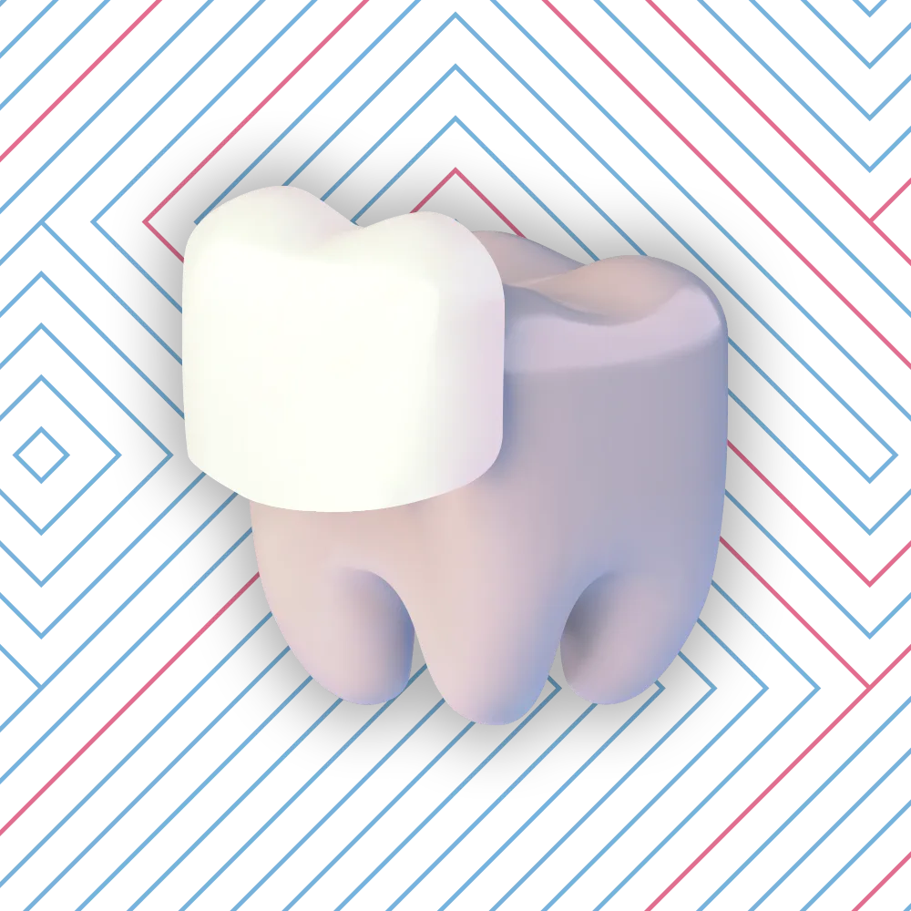3D illustration of a stylized teeth with veneers, separated and floating against a dark blue geometric background with diagonal lines and diamond shapes.