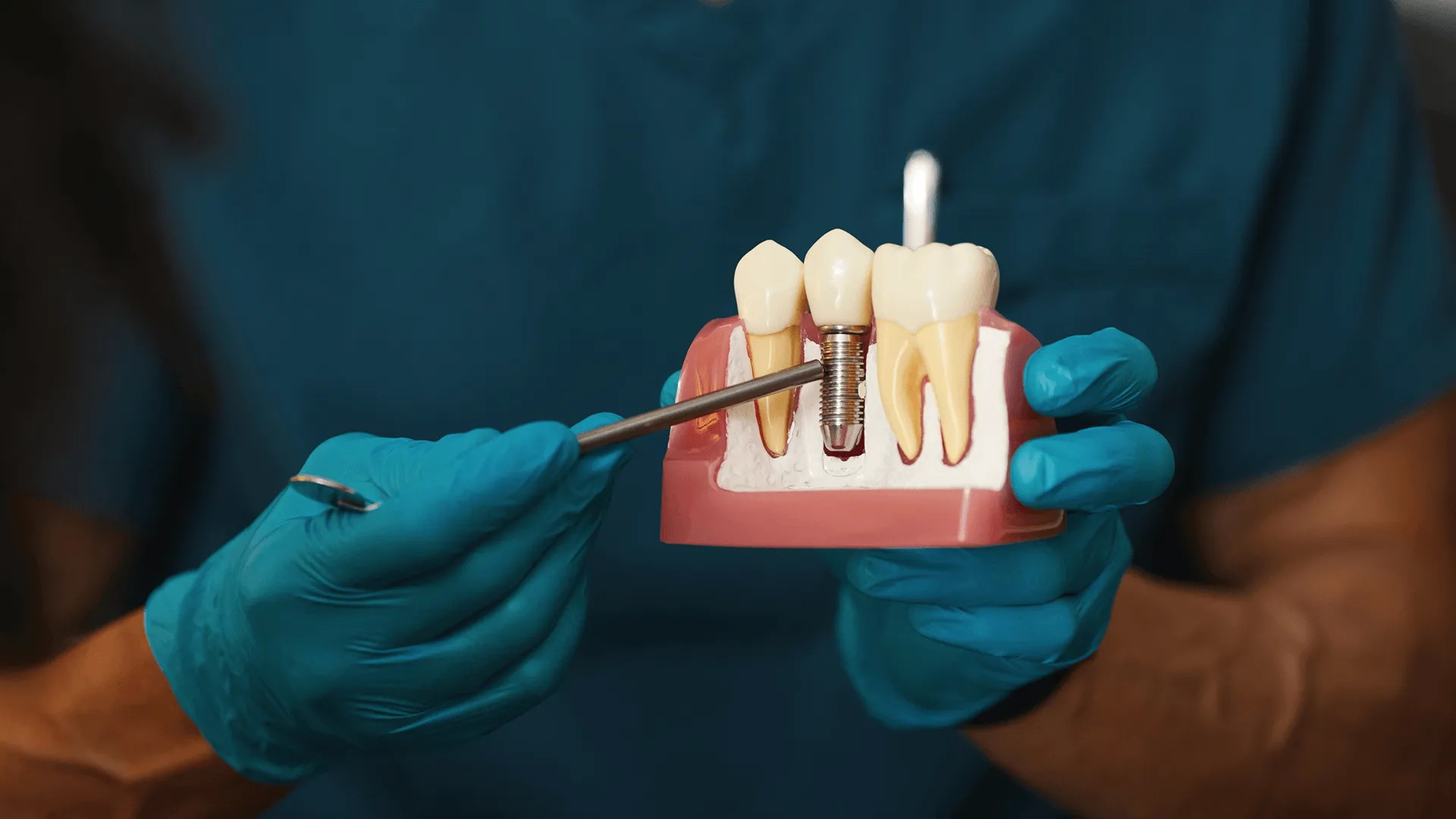 Illustrating Dental Implant Procedure On Model