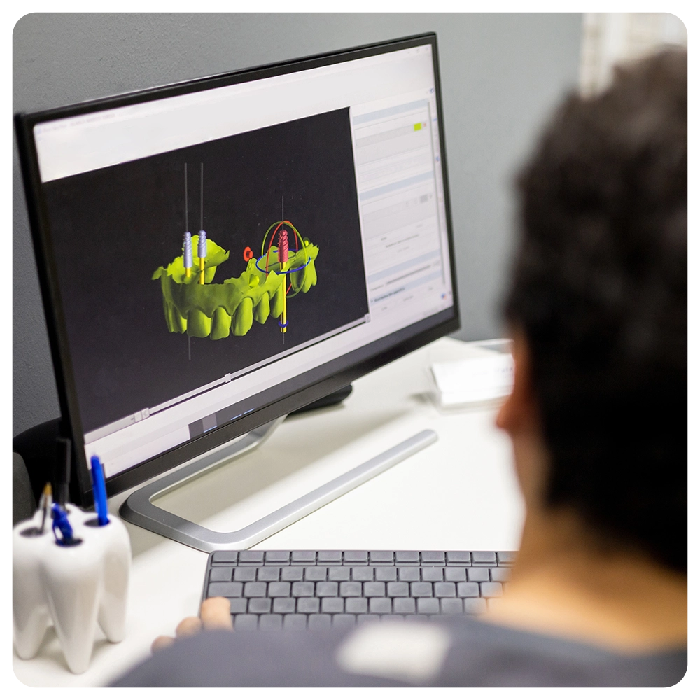 An unrecognizable dentist shows an implant surgery plan on his office monitor through a 3D X-ray. 3D implantology concept.
