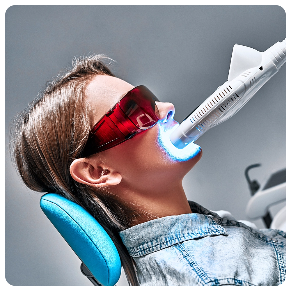 Girl patient in the dental clinic. Teeth whitening UV lamp with photopolymer composition. Side view
