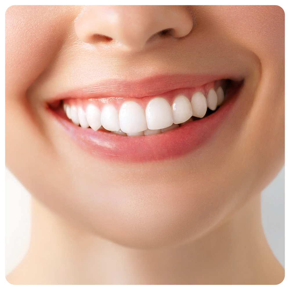 Perfect white teeth smile of a young woman.